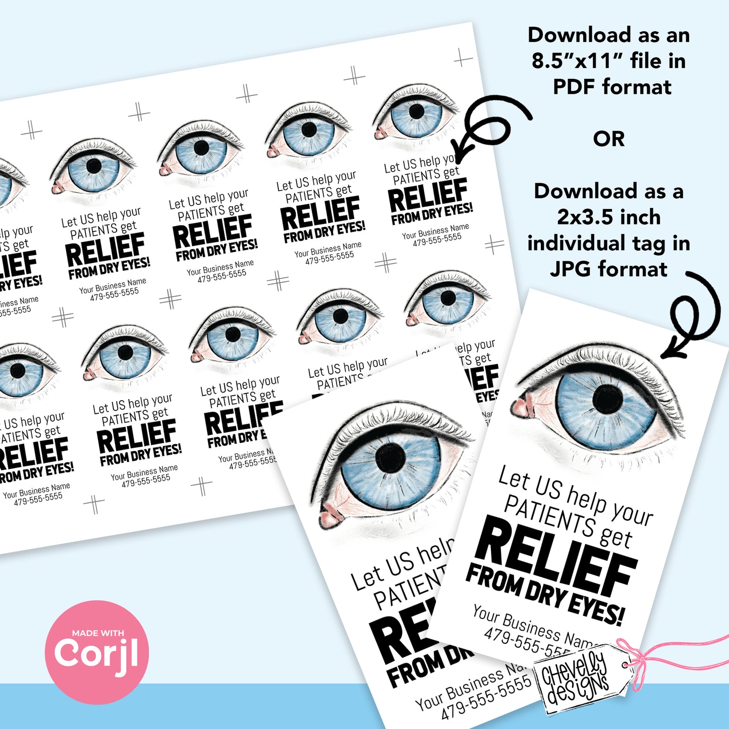 EDITABLE - Dry Eye Relief - Eye Doctor - Printable Referral Marketing Gift Tags